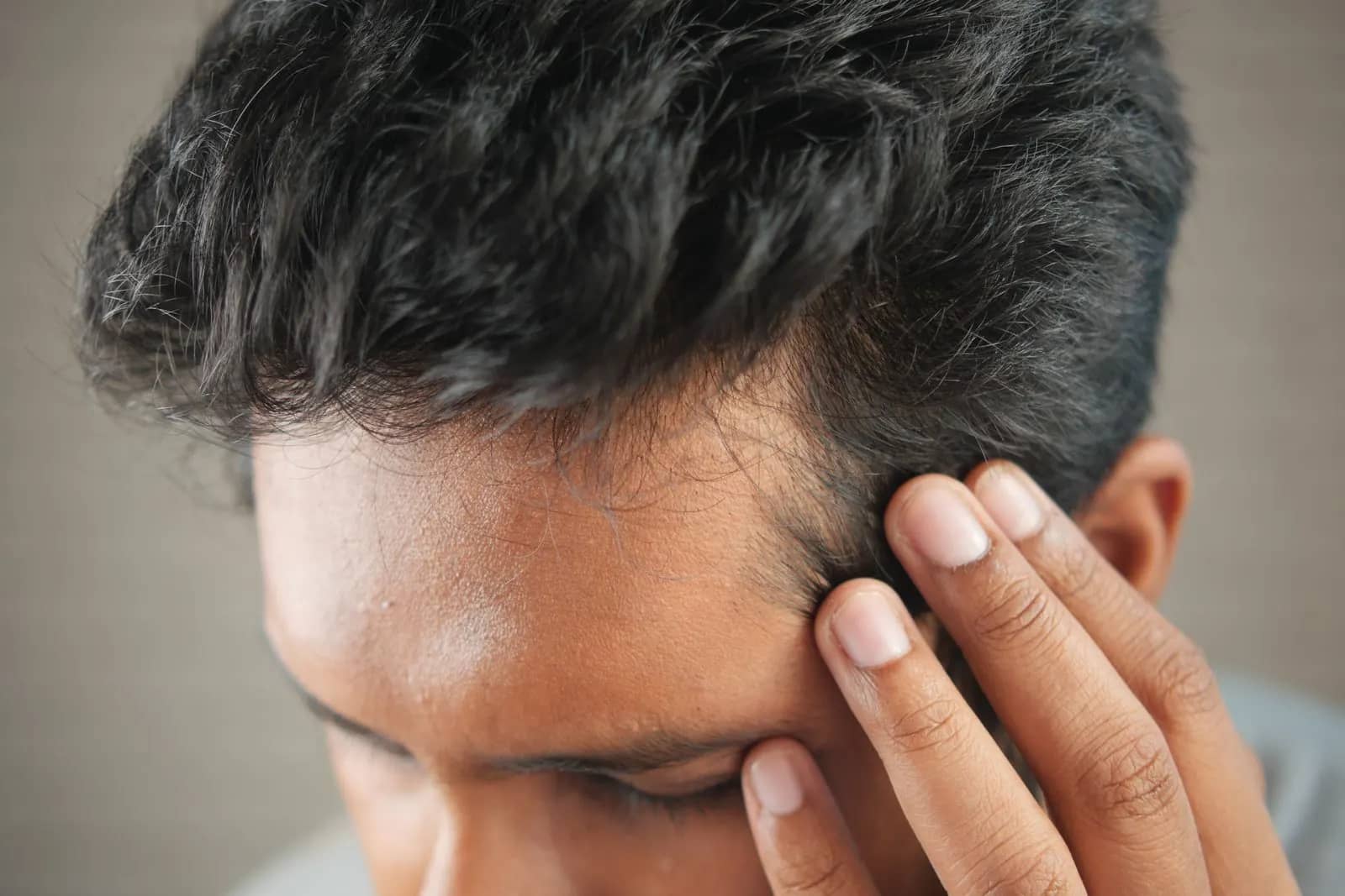 A man touching his hairline